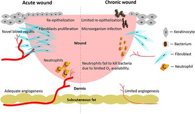 Targeting Tunable Physical Properties of Materials for Chronic <mark class="highlighted">Wound Care</mark>